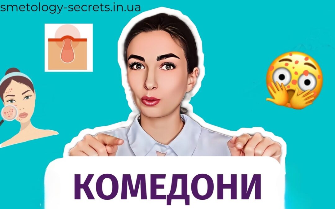 Комедони. Що воно таке та як їх позбутися?
